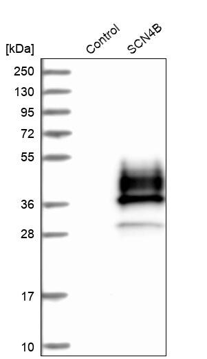 SCN4B Antibody - BSA Free Western Blot: SCN4B Antibody - BSA Free [NBP1-86057]