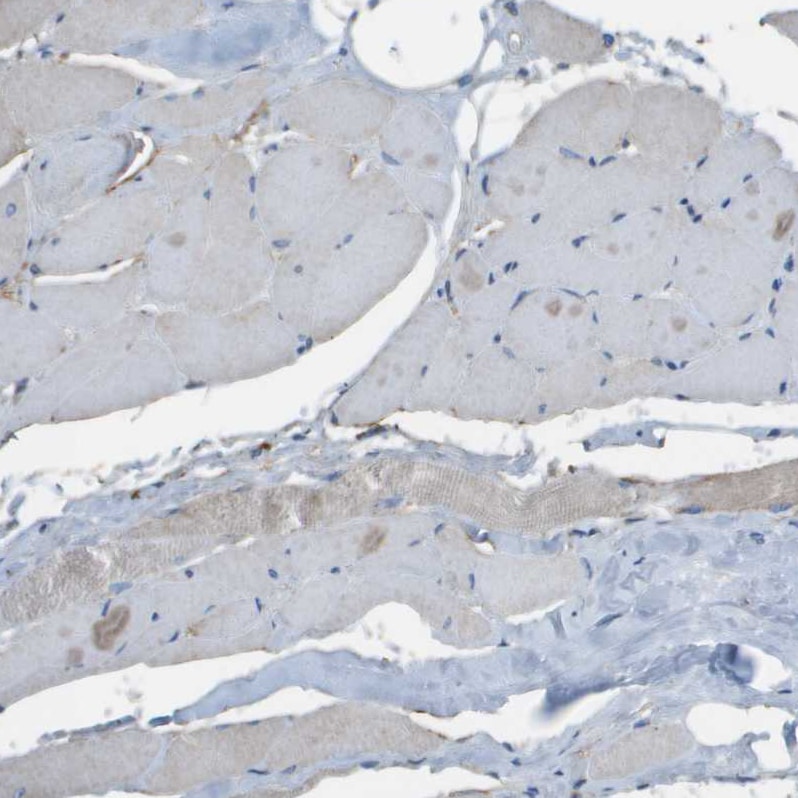 GALNT6 Antibody - BSA Free Immunohistochemistry-Paraffin: GALNT6 Antibody - BSA Free [NBP1-86059]