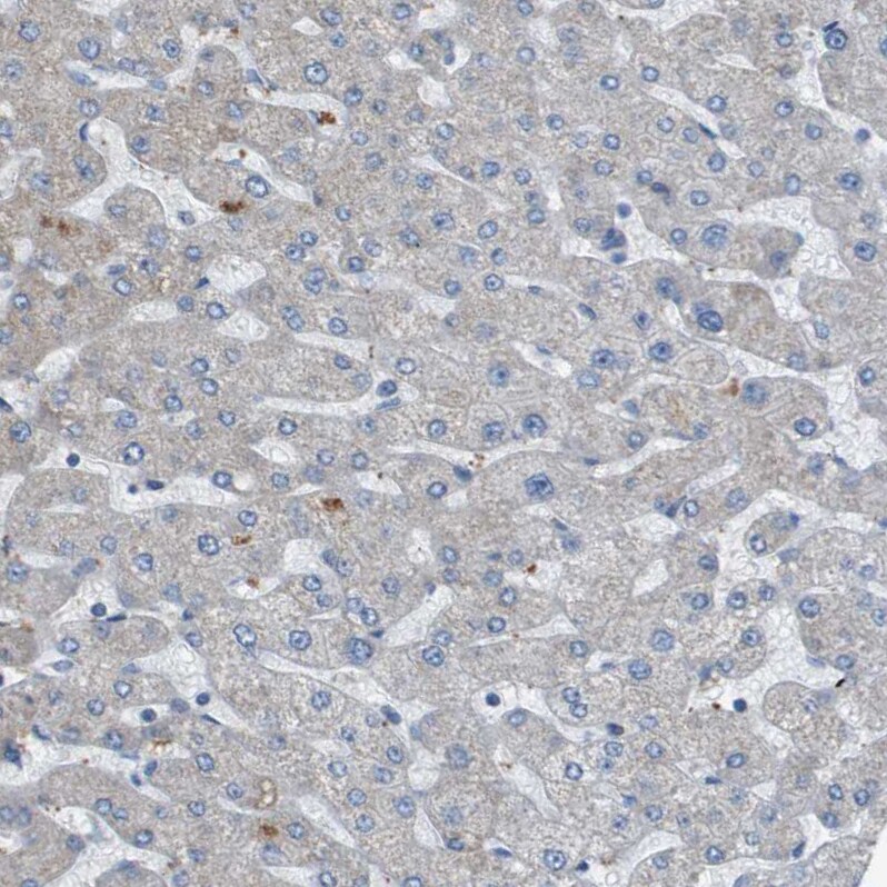 GALNT6 Antibody - BSA Free Immunohistochemistry-Paraffin: GALNT6 Antibody - BSA Free [NBP1-86059]