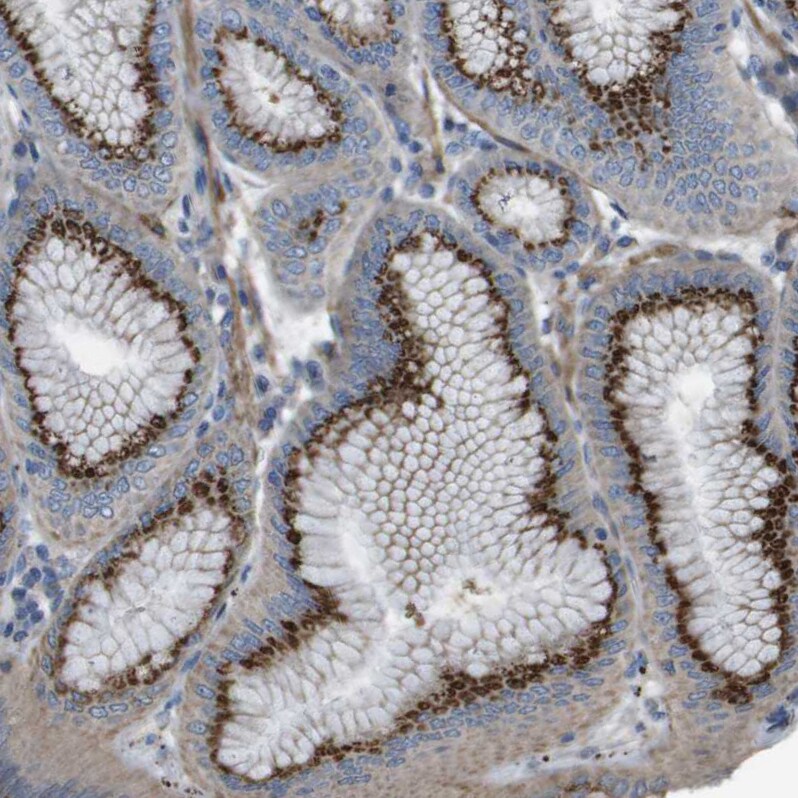 GALNT6 Antibody - BSA Free Immunohistochemistry-Paraffin: GALNT6 Antibody - BSA Free [NBP1-86059]