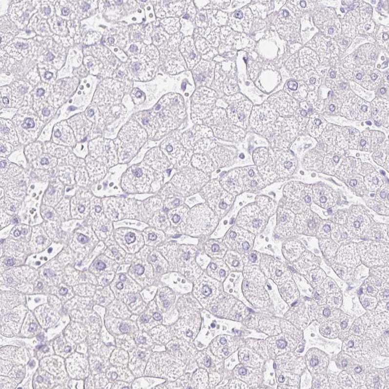 GP2 Antibody - BSA Free Immunohistochemistry-Paraffin: GP2 Antibody - BSA Free [NBP1-86061]