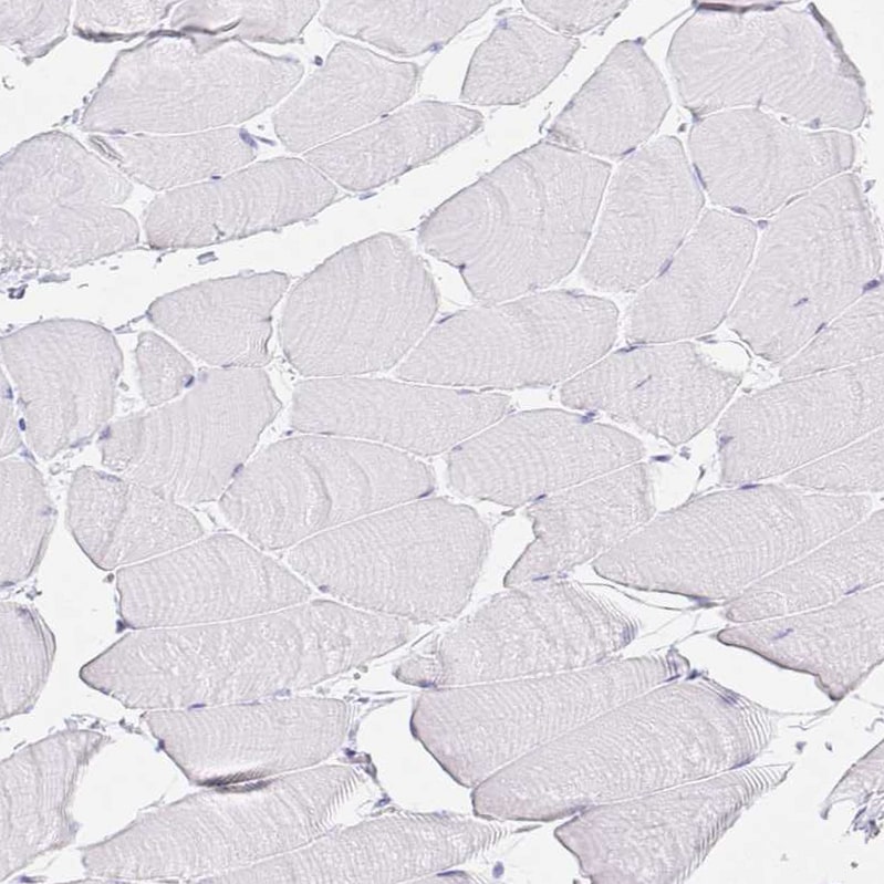 GP2 Antibody - BSA Free Immunohistochemistry-Paraffin: GP2 Antibody - BSA Free [NBP1-86061]