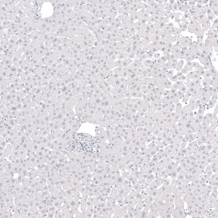 GP2 Antibody - BSA Free Immunohistochemistry-Paraffin: GP2 Antibody - BSA Free [NBP1-86070]