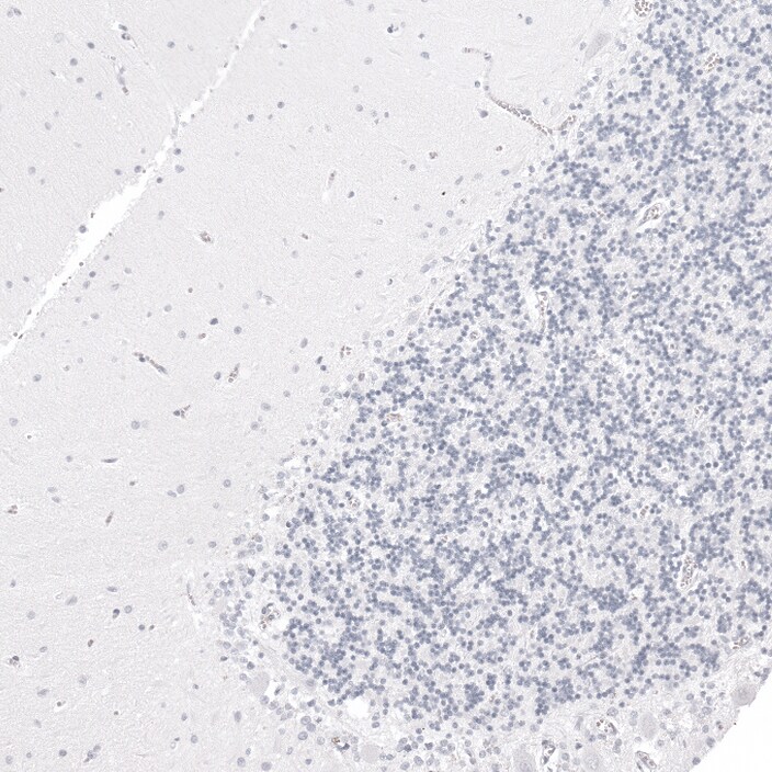 GP2 Antibody - BSA Free Immunohistochemistry-Paraffin: GP2 Antibody - BSA Free [NBP1-86070]