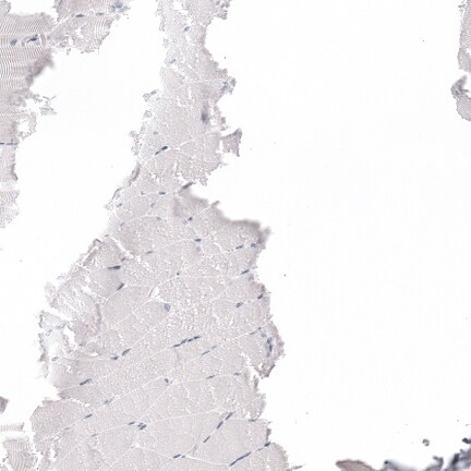 GP2 Antibody - BSA Free Immunohistochemistry-Paraffin: GP2 Antibody - BSA Free [NBP1-86070]