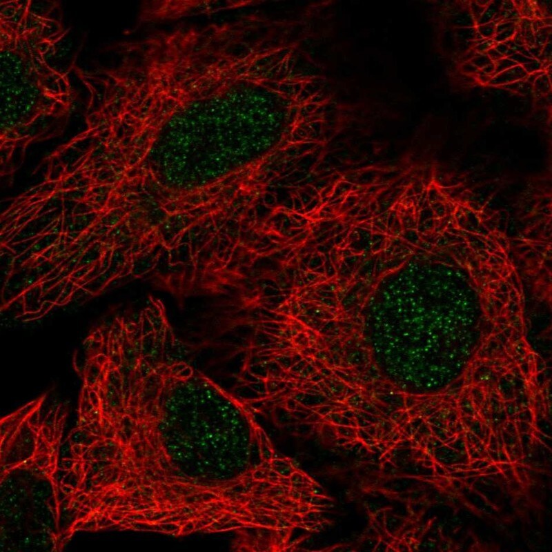 PEPD Antibody - BSA Free Immunocytochemistry/ Immunofluorescence: PEPD Antibody - BSA Free [NBP1-86072]