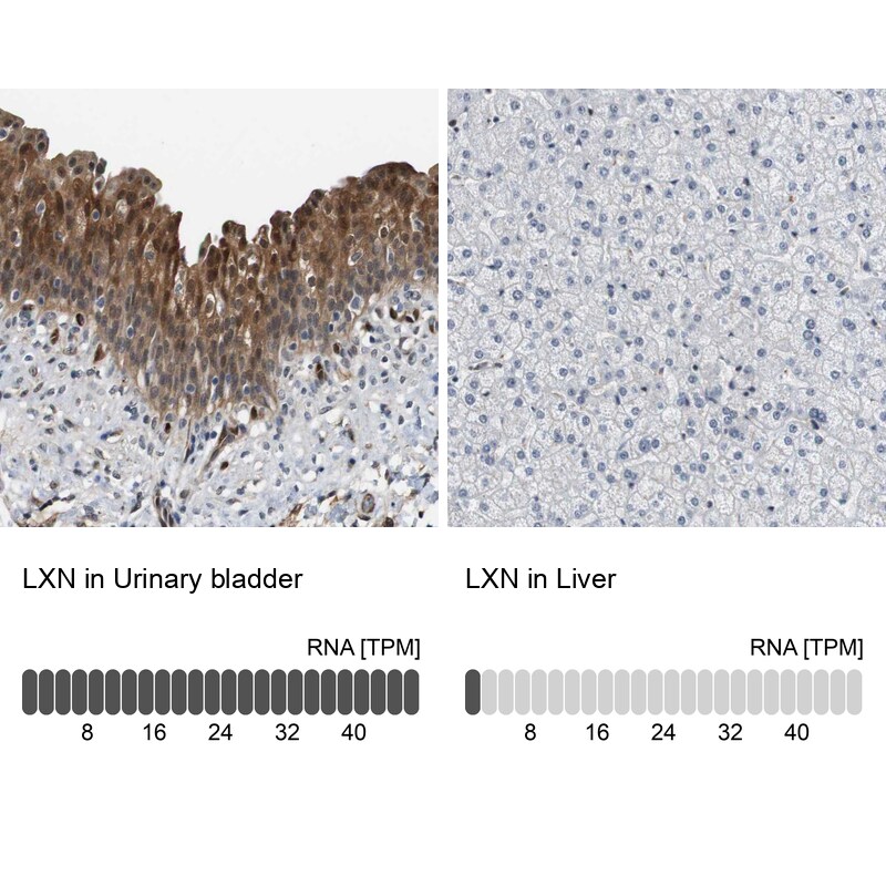 Latexin Antibody - BSA Free Immunohistochemistry-Paraffin: Latexin Antibody - BSA Free [NBP1-86079]