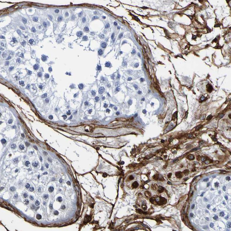DPEP1 Antibody - BSA Free Immunohistochemistry-Paraffin: DPEP1 Antibody - BSA Free [NBP1-86087]