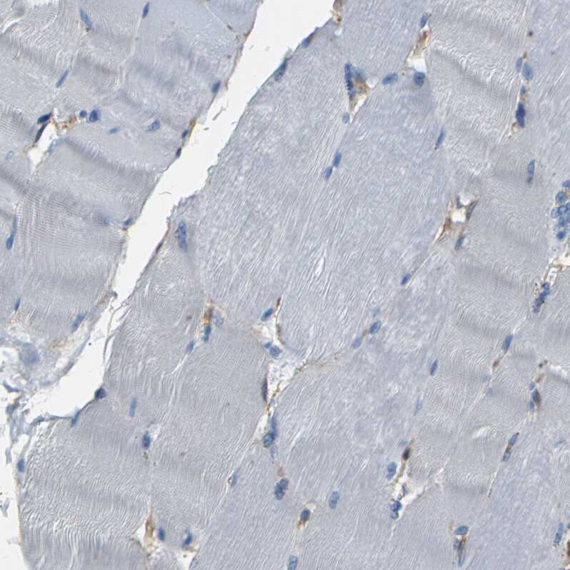 Spectrin beta 2 Antibody - BSA Free Immunohistochemistry-Paraffin: Spectrin beta 2 Antibody - BSA Free [NBP1-86088]