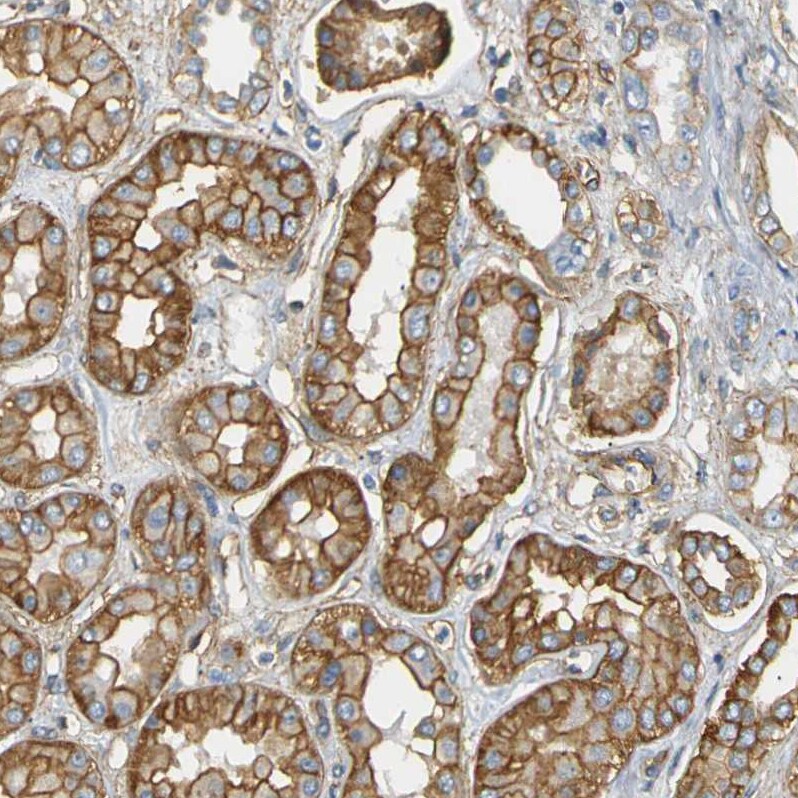 Spectrin beta 2 Antibody - BSA Free Immunohistochemistry-Paraffin: Spectrin beta 2 Antibody - BSA Free [NBP1-86088]