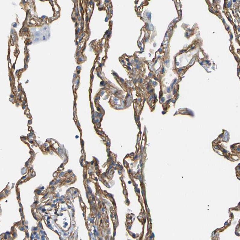 Spectrin beta 2 Antibody - BSA Free Immunohistochemistry-Paraffin: Spectrin beta 2 Antibody - BSA Free [NBP1-86088]