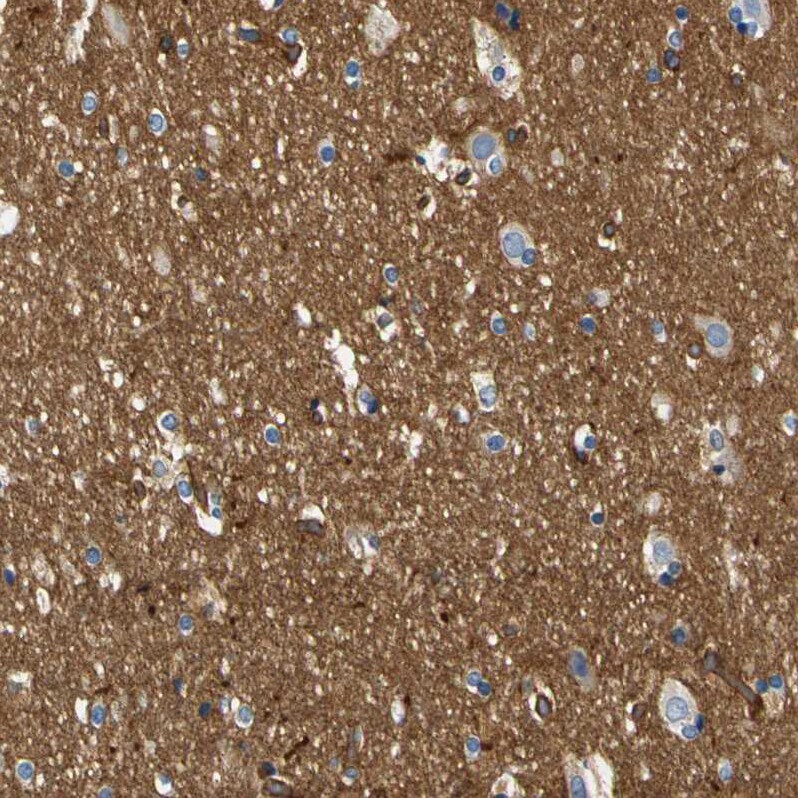 Spectrin beta 2 Antibody - BSA Free Immunohistochemistry-Paraffin: Spectrin beta 2 Antibody - BSA Free [NBP1-86088]