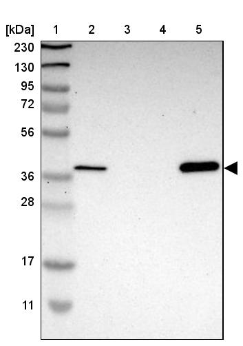 MPPE1 Antibody - BSA Free Western Blot: MPPE1 Antibody - BSA Free [NBP1-86089]