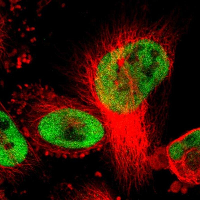 CUL4B Antibody - BSA Free Immunocytochemistry/ Immunofluorescence: CUL4B Antibody - BSA Free [NBP1-86099]