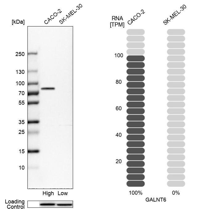 GALNT6 Antibody - BSA Free Western Blot: GALNT6 Antibody - BSA Free [NBP1-86100]