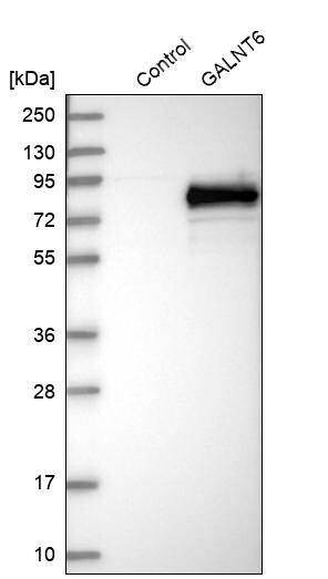 GALNT6 Antibody - BSA Free Western Blot: GALNT6 Antibody - BSA Free [NBP1-86100]