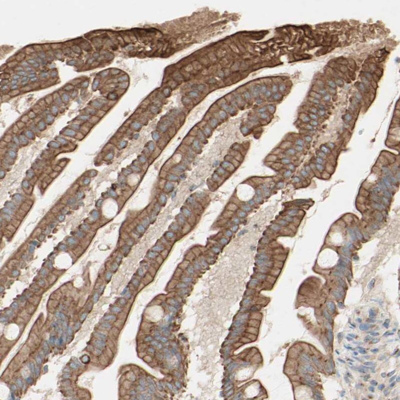 Myotubularin Antibody - BSA Free Immunohistochemistry-Paraffin: Myotubularin Antibody [NBP1-86107]