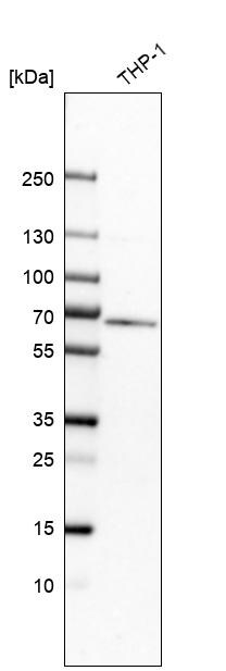 Myotubularin Antibody - BSA Free Western Blot: Myotubularin Antibody - BSA Free [NBP1-86107]