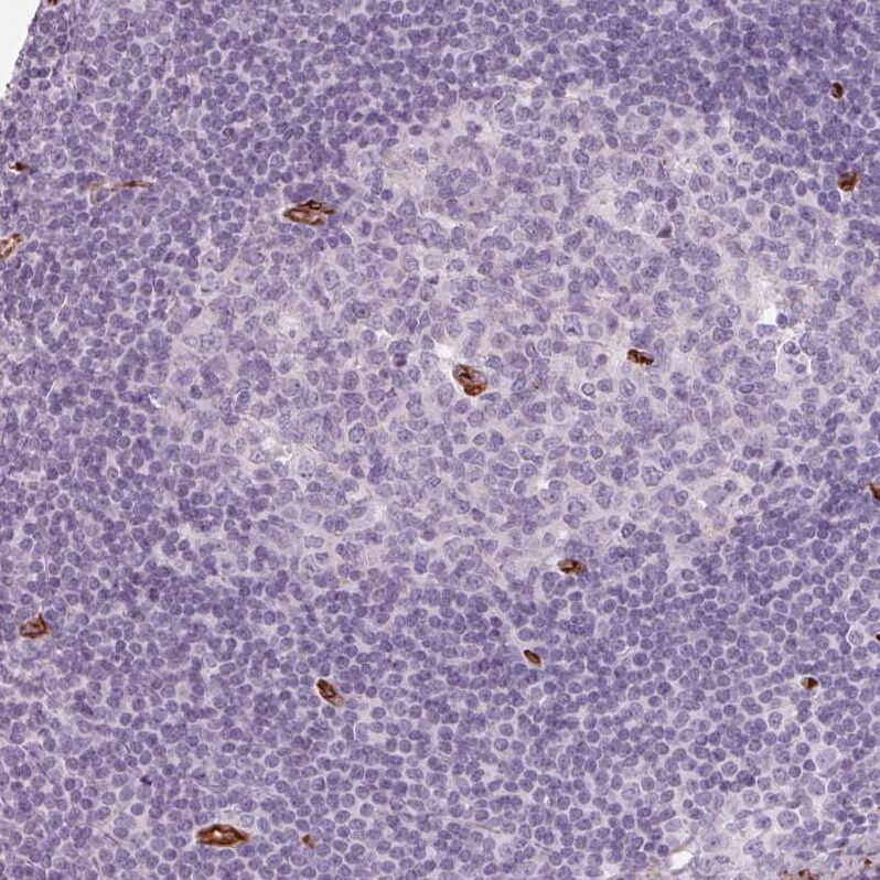 CLPS Antibody - BSA Free Immunohistochemistry-Paraffin: CLPS Antibody - BSA Free [NBP1-86109]