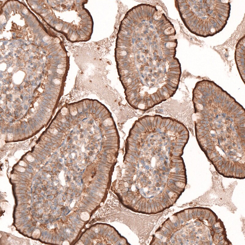 Myotubularin Antibody - BSA Free Immunohistochemistry-Paraffin: Myotubularin Antibody [NBP1-86113]