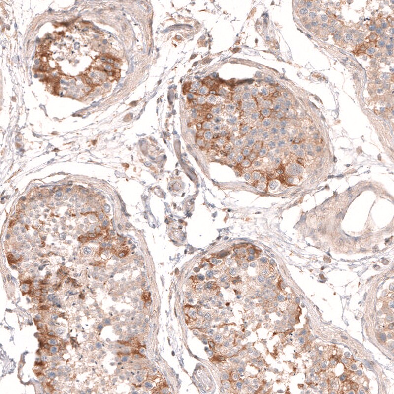 Myotubularin Antibody - BSA Free Immunohistochemistry-Paraffin: Myotubularin Antibody [NBP1-86113]