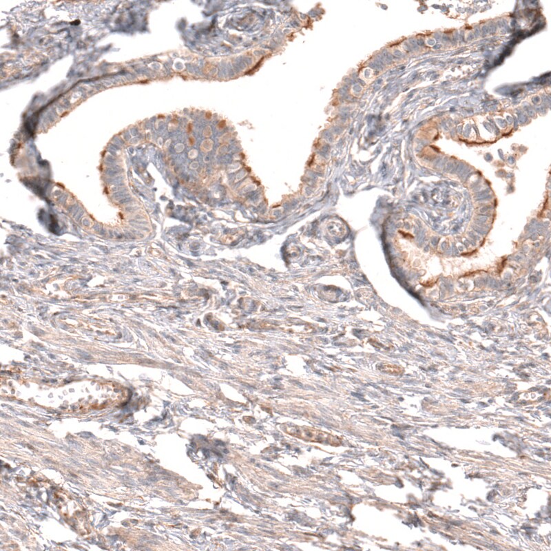 Myotubularin Antibody - BSA Free Immunohistochemistry-Paraffin: Myotubularin Antibody [NBP1-86113]