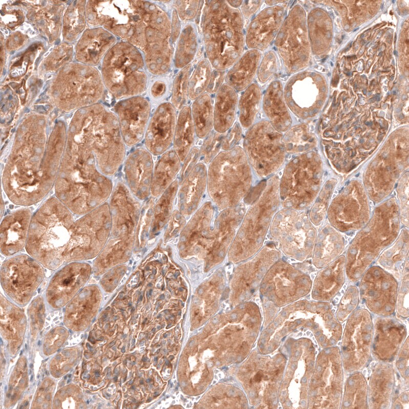Myotubularin Antibody - BSA Free Immunohistochemistry-Paraffin: Myotubularin Antibody [NBP1-86113]