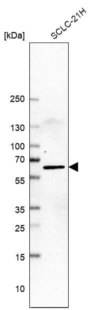 LHX9 Antibody - BSA Free Western Blot: LHX9 Antibody - BSA Free [NBP1-86114]