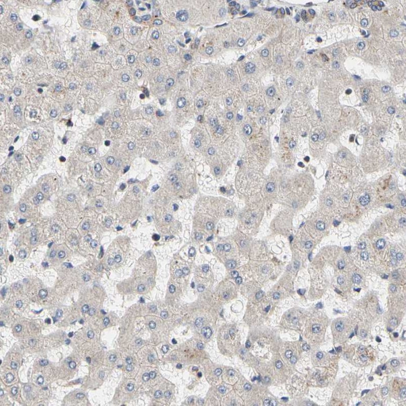 GPD2 Antibody - BSA Free Immunohistochemistry-Paraffin: GPD2 Antibody - BSA Free [NBP1-86121]