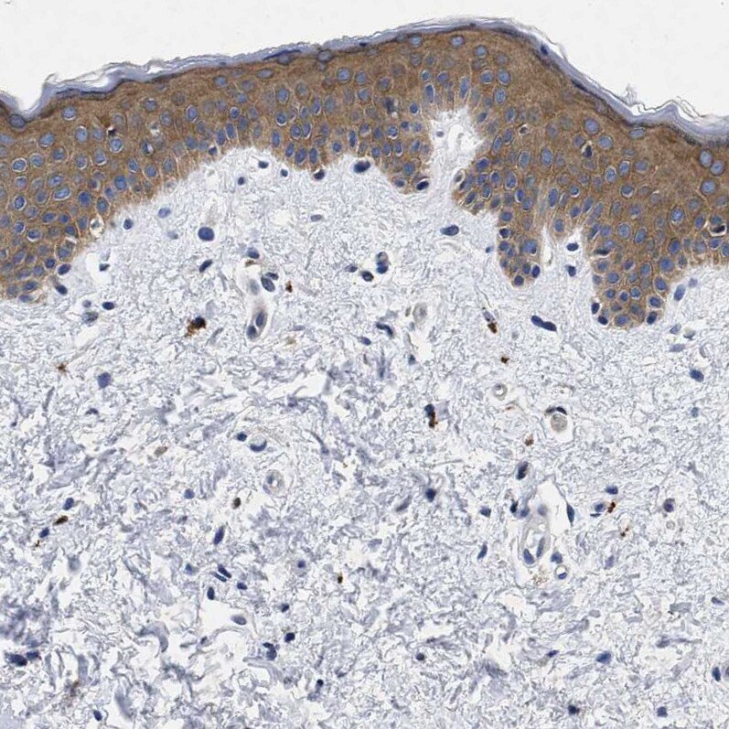 LAD1 Antibody - BSA Free Immunohistochemistry-Paraffin: LAD1 Antibody - BSA Free [NBP1-86126]