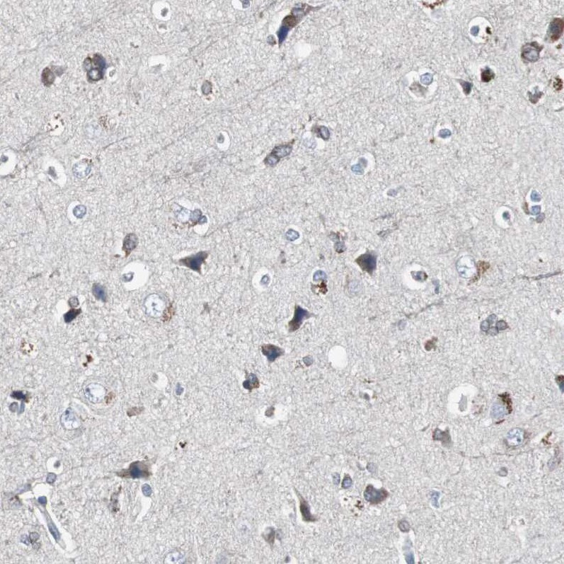ACAA1 Antibody - BSA Free Immunohistochemistry-Paraffin: ACAA1 Antibody - BSA Free [NBP1-86128]