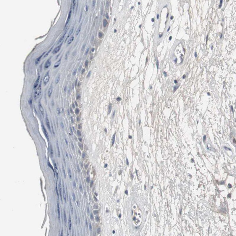 ACAA1 Antibody - BSA Free Immunohistochemistry-Paraffin: ACAA1 Antibody - BSA Free [NBP1-86128]