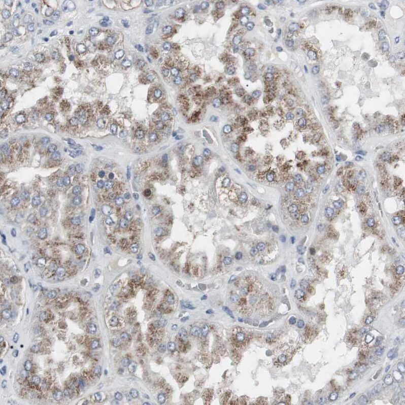 ACAA1 Antibody - BSA Free Immunohistochemistry-Paraffin: ACAA1 Antibody - BSA Free [NBP1-86128]