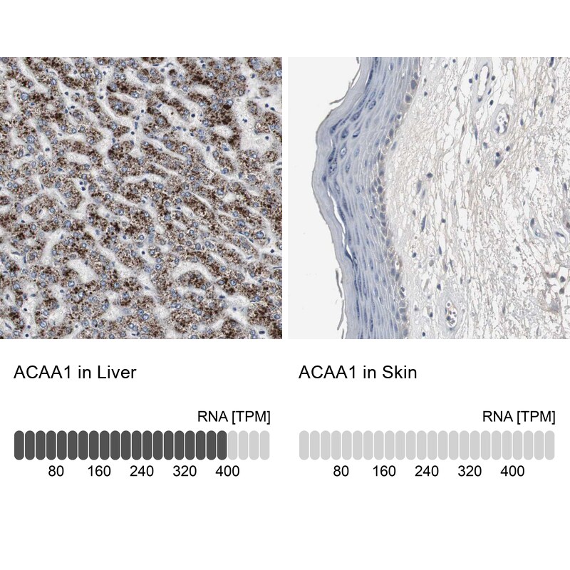 ACAA1 Antibody - BSA Free Immunohistochemistry-Paraffin: ACAA1 Antibody - BSA Free [NBP1-86128]