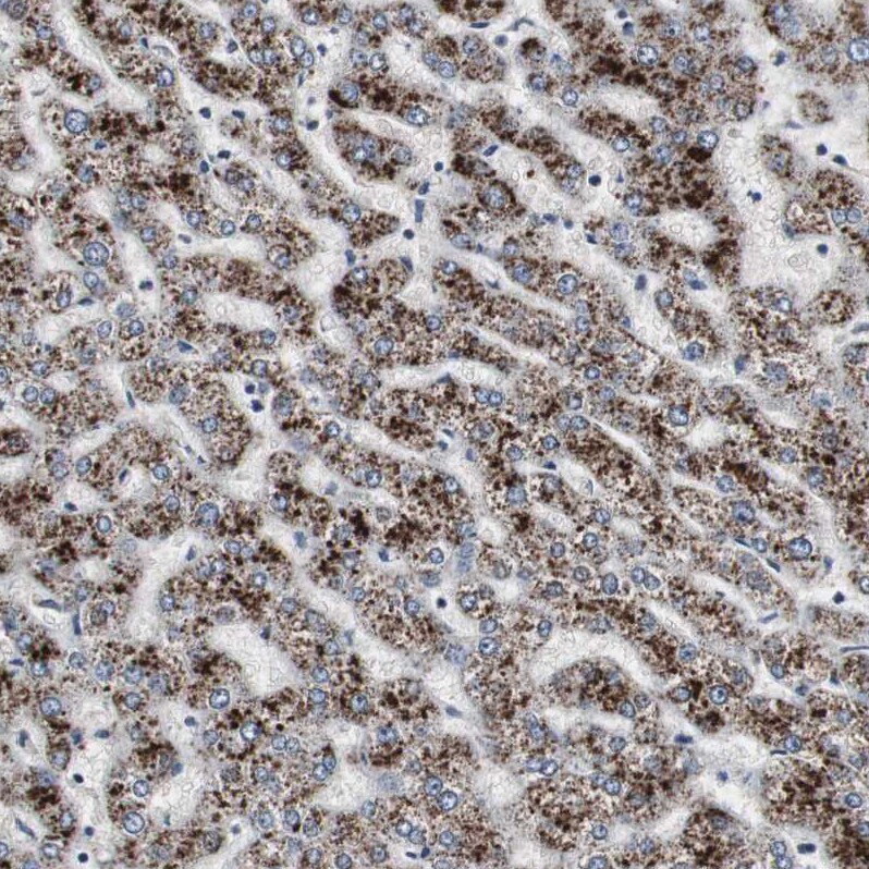 ACAA1 Antibody - BSA Free Immunohistochemistry-Paraffin: ACAA1 Antibody - BSA Free [NBP1-86128]