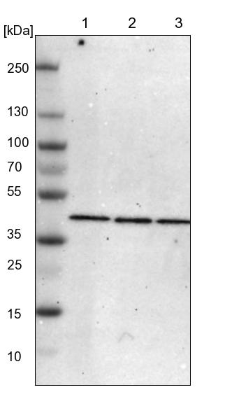ACAA1 Antibody - BSA Free Western Blot: ACAA1 Antibody - BSA Free [NBP1-86128]