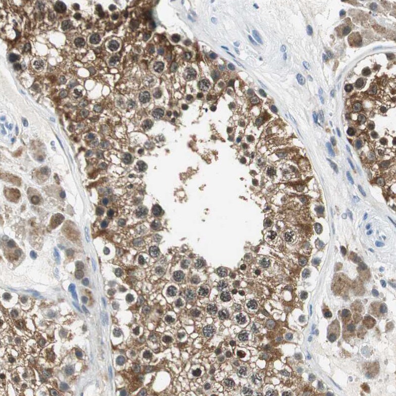 ME1 Antibody - BSA Free Immunohistochemistry-Paraffin: ME1 Antibody - BSA Free [NBP1-86129]
