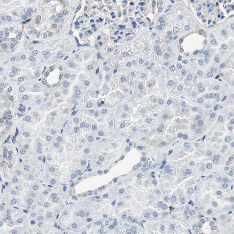 ME1 Antibody - BSA Free Immunohistochemistry-Paraffin: ME1 Antibody - BSA Free [NBP1-86129]