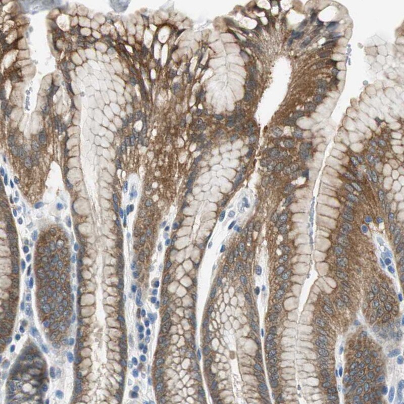 ME1 Antibody - BSA Free Immunohistochemistry-Paraffin: ME1 Antibody - BSA Free [NBP1-86129]