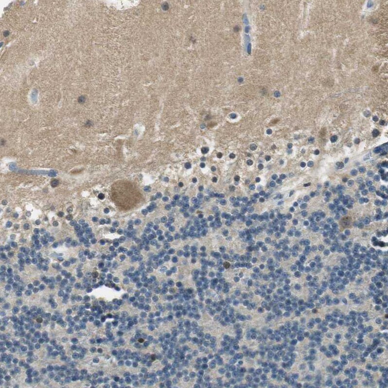 ME1 Antibody - BSA Free Immunohistochemistry-Paraffin: ME1 Antibody - BSA Free [NBP1-86129]