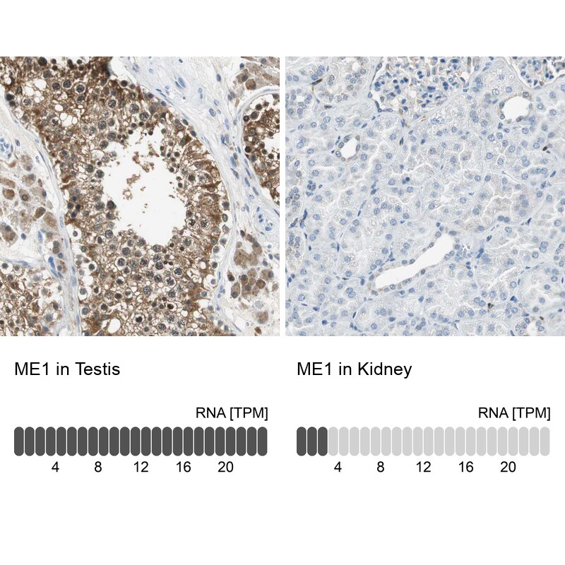 ME1 Antibody - BSA Free Immunohistochemistry-Paraffin: ME1 Antibody - BSA Free [NBP1-86129]