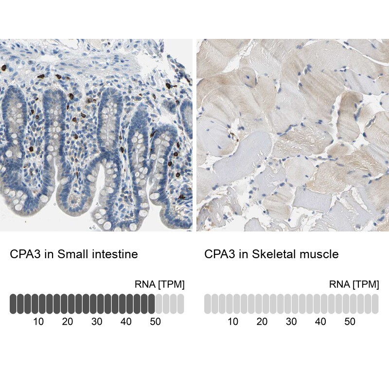 CPA3 Antibody - BSA Free Immunohistochemistry-Paraffin: CPA3 Antibody - BSA Free [NBP1-86130]