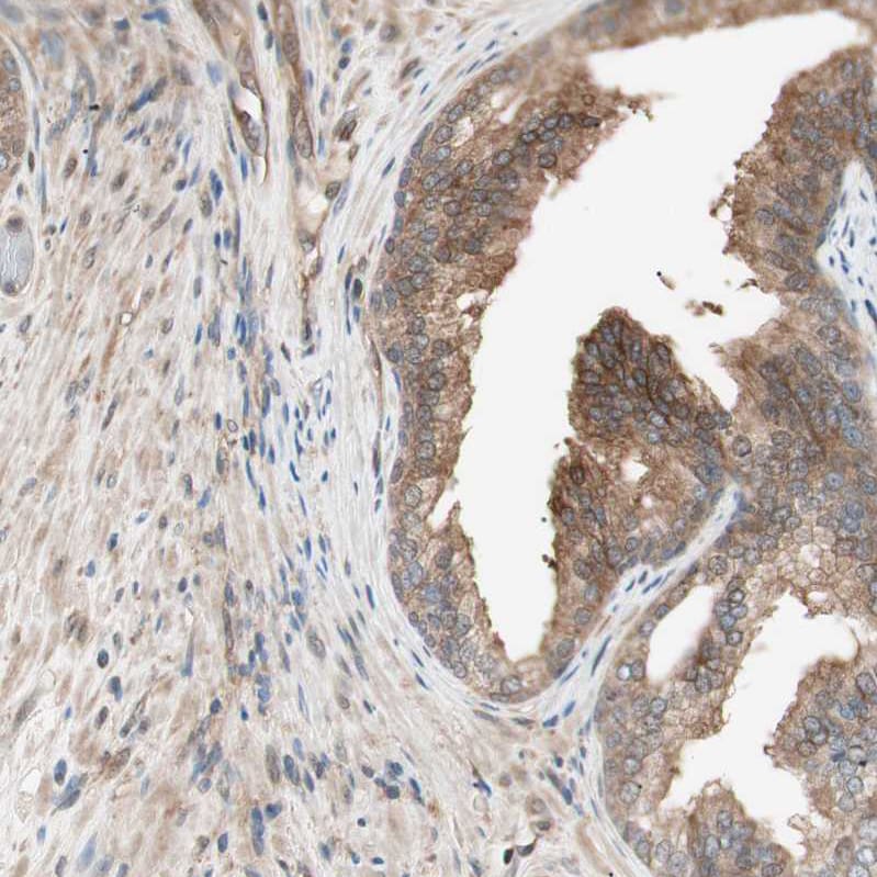GALT Antibody - BSA Free Immunohistochemistry-Paraffin: GALT Antibody - BSA Free [NBP1-86133]