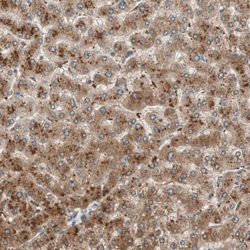 GALT Antibody - BSA Free Immunohistochemistry-Paraffin: GALT Antibody - BSA Free [NBP1-86133]
