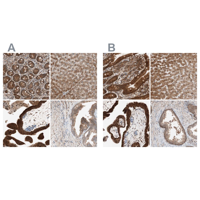 GALT Antibody - BSA Free Immunohistochemistry-Paraffin: GALT Antibody - BSA Free [NBP1-86133]