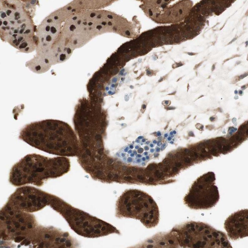 GALT Antibody - BSA Free Immunohistochemistry-Paraffin: GALT Antibody - BSA Free [NBP1-86133]