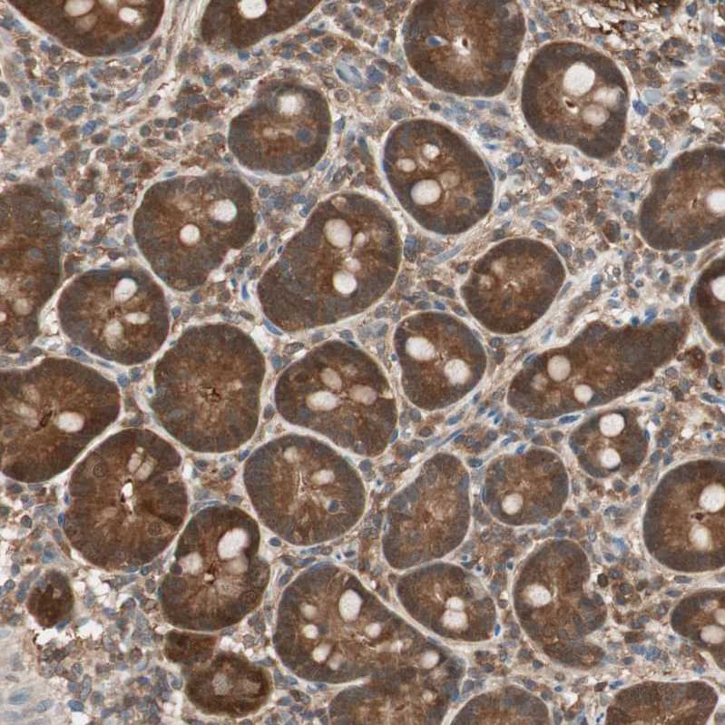 GALT Antibody - BSA Free Immunohistochemistry-Paraffin: GALT Antibody - BSA Free [NBP1-86133]