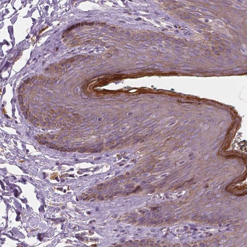 RNASE7 Antibody - BSA Free Immunohistochemistry-Paraffin: RNASE7 Antibody - BSA Free [NBP1-86134]