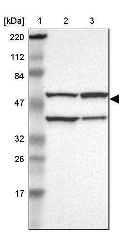 CECR5 Antibody - BSA Free Western Blot: CECR5 Antibody - BSA Free [NBP1-86136]