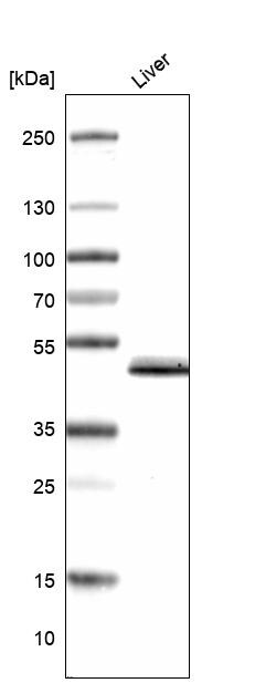 GALT Antibody - BSA Free Western Blot: GALT Antibody - BSA Free [NBP1-86138]
